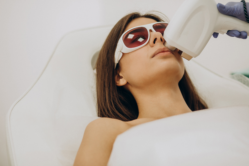 Permanent Upper Lip Hair Removal